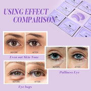 Under Eye Patches with Vitamin C and Witch Hazel Eye Mask for Dark Circles and Puffiness,Face Mask Skin Care Products 30 P...