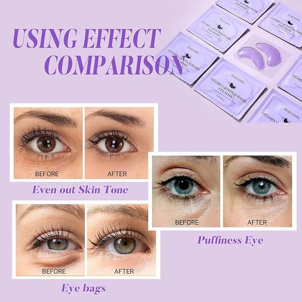 Under Eye Patches with Vitamin C and Witch Hazel Eye Mask for Dark Circles and Puffiness,Face Mask Skin Care Products 30 P...