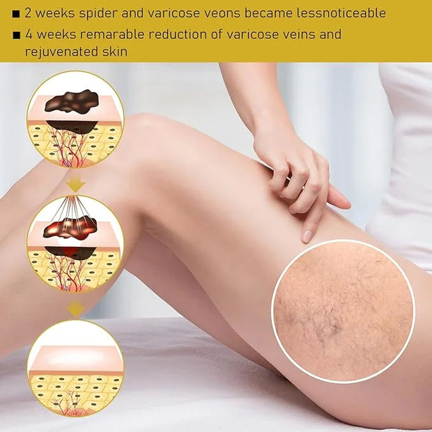 2pc Bee Venom Face Cream - Reduce Blemishes, All-Natural Formula - Product Image