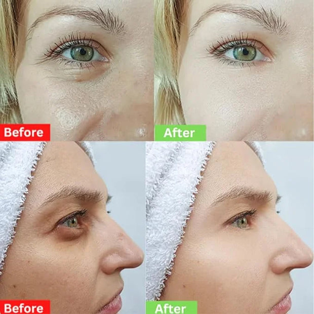 Instant Eye Tightener Cream,Under Eye Tightening Cream for Firm and Smooth the Look of Fine Lines,Reduces Dark Circles, Ba...