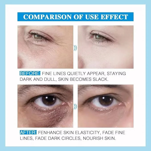 Eye Lift Eye Cream Anti-Wrinkle - Product Image