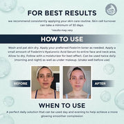 Hyaluronic Acid Face Serum - Hydrating Anti Wrinkle Anti Aging Facial Serum - With Vitamin C and E, Green Tea, Jojoba Oil ...