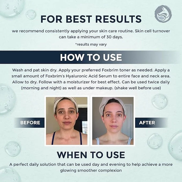Hyaluronic Acid Face Serum - Hydrating Anti Wrinkle Anti Aging Facial Serum - With Vitamin C and E, Green Tea, Jojoba Oil ...