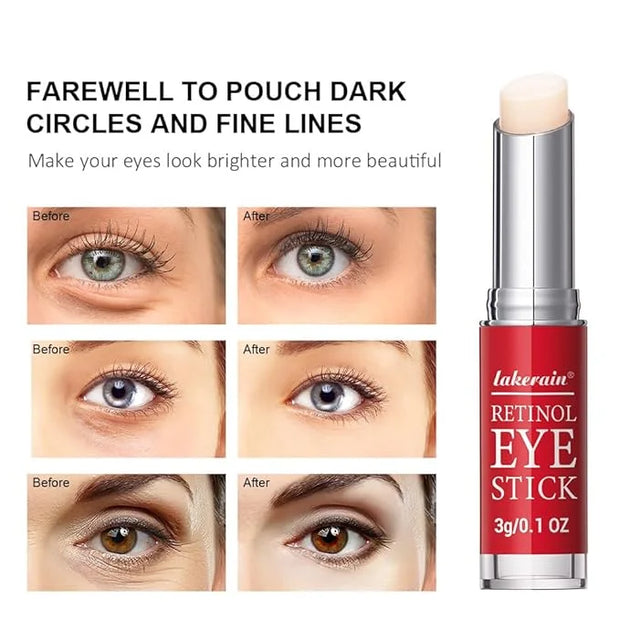 Retinol Eye Stick, Retinol Eye Cream With Collagen,Hyaluronic Acid For Dark Circle, Wrinkles, Under Eye Cream Anti Aging, ...