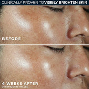 RoC Multi Correxion Revive + Glow Vitamin C Broad Spectrum SPF 30 Moisturizer (1.7 oz) with Retinol Eye Cream Packette - P...