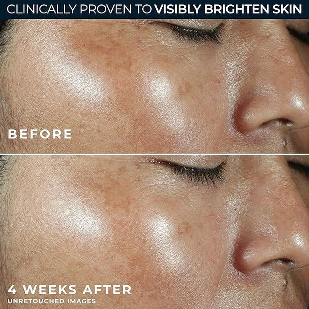 RoC Multi Correxion Revive + Glow Vitamin C Broad Spectrum SPF 30 Moisturizer (1.7 oz) with Retinol Eye Cream Packette - P...