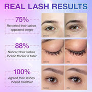 Lash Serum - Rapid Eyelash Growth Serum,eyelash serum,Enhancing Growth Thickness,Boost Thicker, Fuller, and Longer Lashes ...