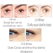 Under Eye Bags Treatment, Rose Eye Mask, Eye Treatment Mask, For Moisturizing,Revitalizing, Lift & Firm, Anti- Dark Circle...