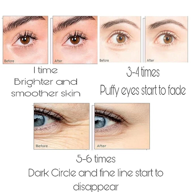 Under Eye Bags Treatment, Rose Eye Mask, Eye Treatment Mask, For Moisturizing,Revitalizing, Lift & Firm, Anti- Dark Circle...
