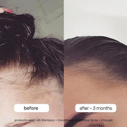 BONDIBOOST Intensive Thickening Spray [4.23 fl oz], Daily Leave In Hair Treatment to Reduce Hair Loss, Lightweight Mist fo...