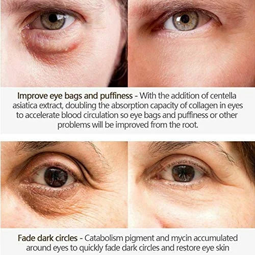 Magic Eye Cream, Instantly Remove Under Eye Bags Wrinkles Puffiness Dark Circles and Fine Lines, Anti Aging Eye Cream for ...
