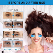 Under Eye Masks for Dark Circles and Puffiness 70PCS, Under Eye Patches for Puffy Eyes Treatment, Under Eye Gel Pads w/Col...