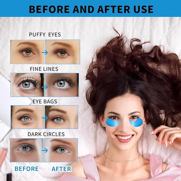Under Eye Masks for Dark Circles and Puffiness 70PCS, Under Eye Patches for Puffy Eyes Treatment, Under Eye Gel Pads w/Col...