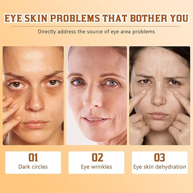 2Pcs Lumibalm For Under Eye Bags, Lumibalm Retinol Eye Serum, Deeply Moisturizes & Reduce Fine Lines (A) - Product Image