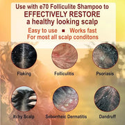 Folliculitis Treatment Hair Conditioner | Moisturize Sensitive Skin, Itchy, Dry Scalp & Damaged Hair Repair | Herbal Extra...