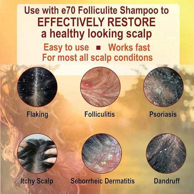 Folliculitis Treatment Hair Conditioner | Moisturize Sensitive Skin, Itchy, Dry Scalp & Damaged Hair Repair | Herbal Extra...