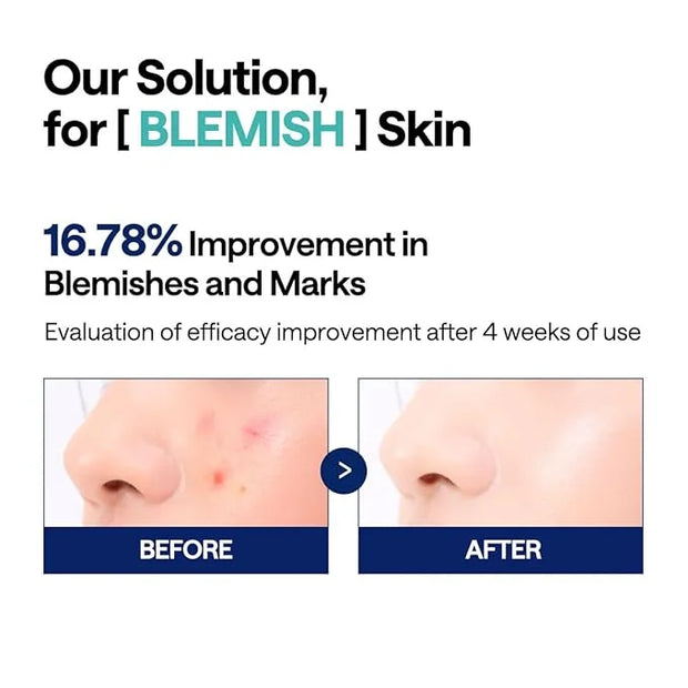 Mediheal Vita Collagen Under Eye Patches & Madecassoside Blemish Toner Pad for Daily Blemish Care - Product Image