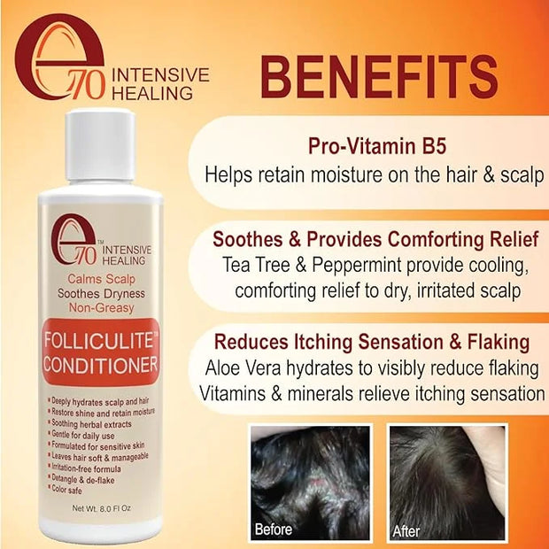Folliculitis Treatment Hair Conditioner | Moisturize Sensitive Skin, Itchy, Dry Scalp & Damaged Hair Repair | Herbal Extra...