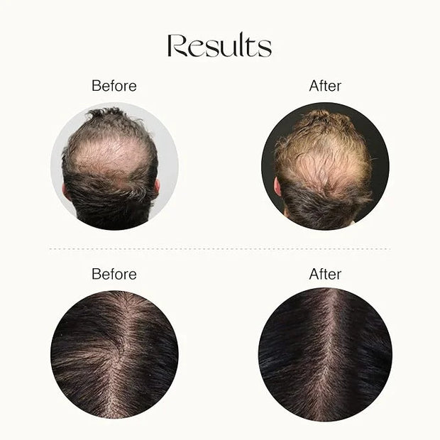 Nourish Mantra Eyebrow Growth Serum 10 ml and Advanced Hair Regrowth Serum 50ml - Product Image