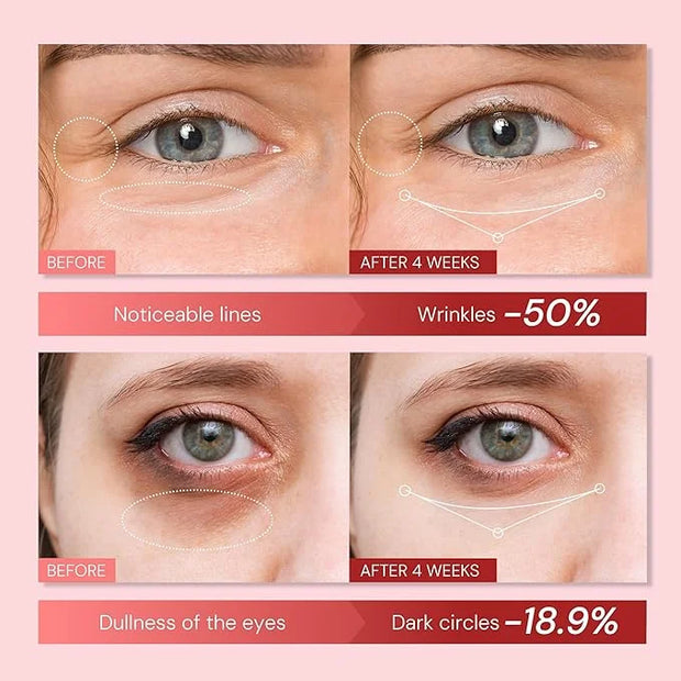 Retinol & Polypeptides Anti-Aging Eye Cream: Under Eye Treatment Reduces Wrinkles, Fine Lines, Dark Circles, Crow’s Feet &...