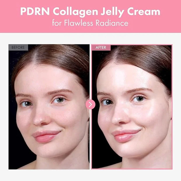 PDRN Collagen Jelly Cream, 5,000ppm Salmon DNA PDRN, Niacinamide, Hydrolyzed Collagen, Glow, Hydrating, Firming, Uneven Sk...