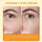 Vitamin C Eye Cream For Dark Circles, Under Eye Cream Anti Wrinkles For Reduce Puffiness And Bags Fine Lines, Wrinkles, Hy...