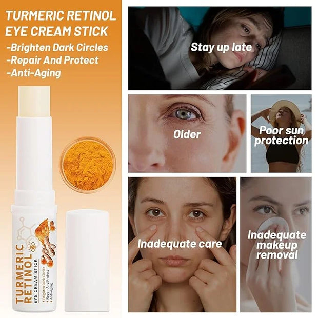 2 PCS Turmeric Retinol Eye Cream Stick, Lumibalm for Under Eye Bags,Eye Balm Stick Hydrating,Turmeric Eye Cream For Puffin...