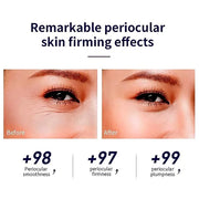 Snail Peptide Advanced Under Eye Cream for Dark Circles, with 360° Massage Ball Reduces Wrinkles &Fine Lines, Eye Essence ...