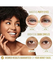 24k Gold Eye Mask Formulated for Puffy Eyes & Dark Circles for Men and Women 20 Pairs Under Eye Patches for Maximum Result...