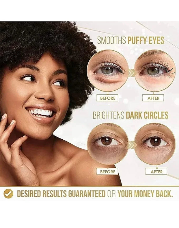 24k Gold Eye Mask Formulated for Puffy Eyes & Dark Circles for Men and Women 20 Pairs Under Eye Patches for Maximum Result...
