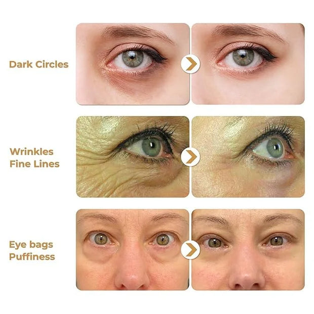 ABERA Natural Repair Eye Cream with Set 15 Eye Masks, Minimizes Under Eye Bags & Dark Circles, Reduce Puffiness, Wrinkles ...
