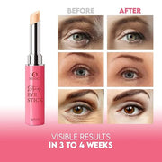 Instant Eye Bag Remover, Retinol Eye Cream for Dark Circles, Under Eye Brightener Stick, Under Eye Cream Anti Aging, Eye C...
