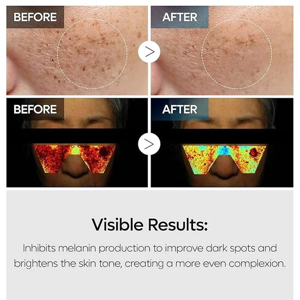 TX Tranexamic Acid Care Line TX cream+Toner+Ampoule+Cleanser Powerful Dark Spot Care | Visible Improvement in 4-8 Weeks - ...