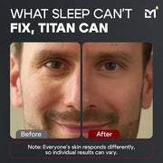 Titan Mens Eye Cream Anti Aging Bags & Dark Circle - Eye Bags Treatment for Men, High Potency Cooling Eye Gel Puffy Eyes T...