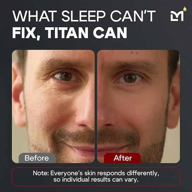 Titan Mens Eye Cream Anti Aging Bags & Dark Circle - Eye Bags Treatment for Men, High Potency Cooling Eye Gel Puffy Eyes T...