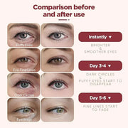 Under Eye Patches (20 Pairs), pink Hyaluronic Acid Eye Patches For Puffy Eyes, Dark Circles, Puffiness, Refresh,Revitalizi...