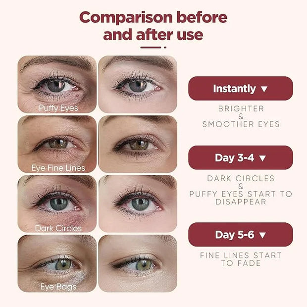 Under Eye Patches (20 Pairs), pink Hyaluronic Acid Eye Patches For Puffy Eyes, Dark Circles, Puffiness, Refresh,Revitalizi...