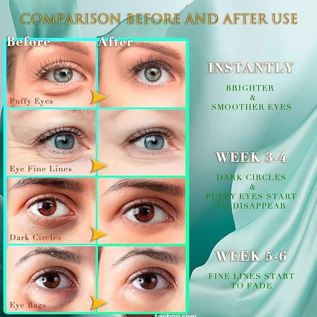 Green Seaweed Eye Mask– 60 Pcs - Gold Under Eye Mask Retinol & Collagen - Puffy Eyes and Dark Circles Treatments – Look Yo...