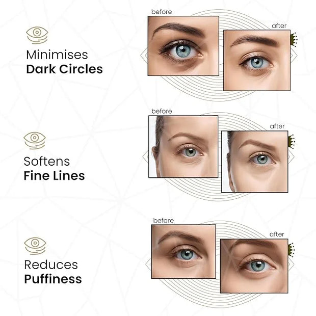 24k Gold Under Eye Collagen Patches, Reduce Puffy Eyes & Dark Circles, Illuminate Tired Eye Masks - Firms, Brightens, Ener...