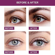 EYELASH Growth Serum for Longer Fuller Healthier Eyelashes and Brows Natural Formula 5ML (5ML, Count, 1) - Product Image