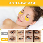 Under Eye Patches 70PCS, 24K Gold Eye Patches for Puffy Eyes Treatment, Under Eye Masks for Dark Circles and Puffiness, No...