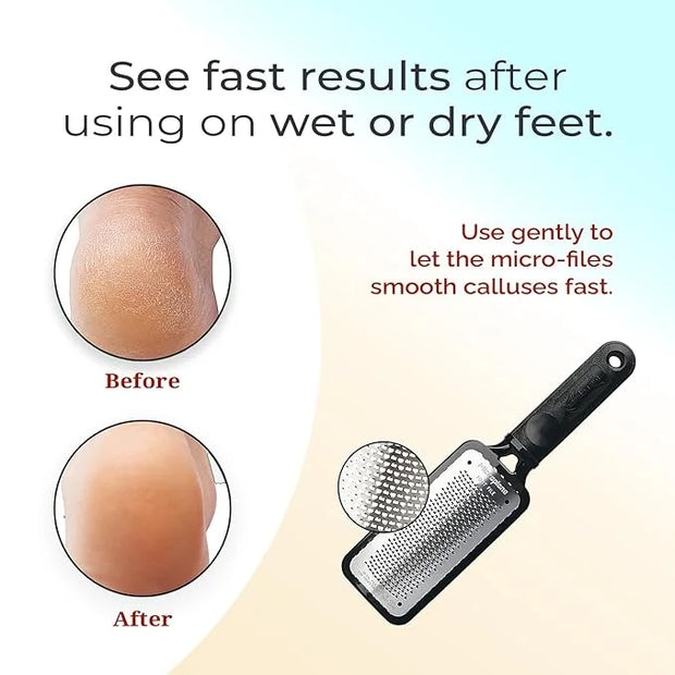 Microplane Colossal Foot File Scraper - The Original Stainless Steel Foot Rasp, Dead Skin/Callus Remover for Feet, Gentle ...
