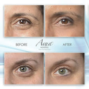 Puffy Eye GEL Instant results – Naturally rapid reduction eye gel, Eliminate Wrinkles, Puffiness and Bags – Hydrating Eye ...