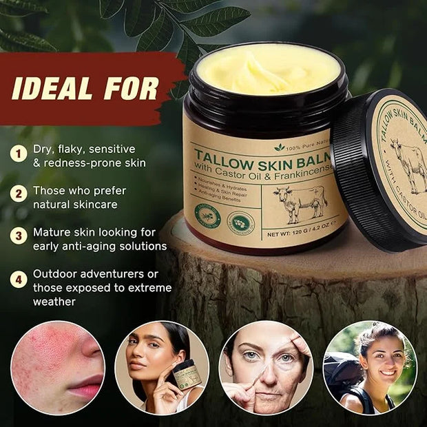 Tallow Castor Oil Frankincense Oil Handmade Skin Balm, Face & Body Moisturizer for Sensitive Skin, Eczema All-Purpose Balm...
