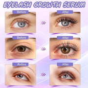 Premium Eyelash Growth Serum and Eyebrow Enhancer by Aomock, Lash Serum - 5ml,Lash Boost Serum for Longer, Fuller, Thicker...
