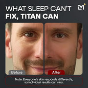 Titan Mens Eye Cream Anti Aging Bags & Dark Circle - Eye Bags Treatment for Men, High Potency Wrinkle Cream for Men, Herba...