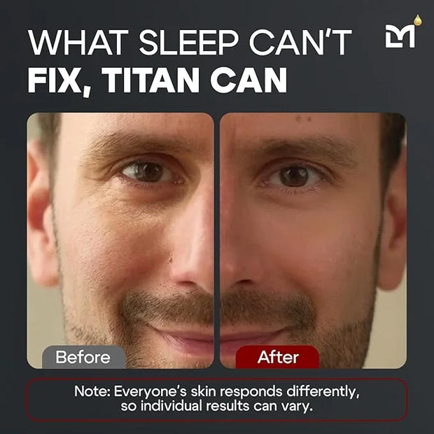 Titan Mens Eye Cream Anti Aging Bags & Dark Circle - Eye Bags Treatment for Men, High Potency Wrinkle Cream for Men, Herba...