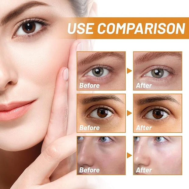 2 PCS Turmeric Retinol Eye Cream Stick, Lumibalm for Under Eye Bags,Eye Balm Stick Hydrating,Turmeric Eye Cream For Puffin...