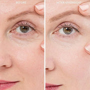 20X Reusable Expression Line Smoothing, Medical-Grade Silicone for Overnight Wrinkle Reduction & Anti-Aging Hydration, Bea...