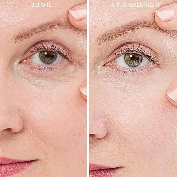 20X Reusable Expression Line Smoothing, Medical-Grade Silicone for Overnight Wrinkle Reduction & Anti-Aging Hydration, Bea...